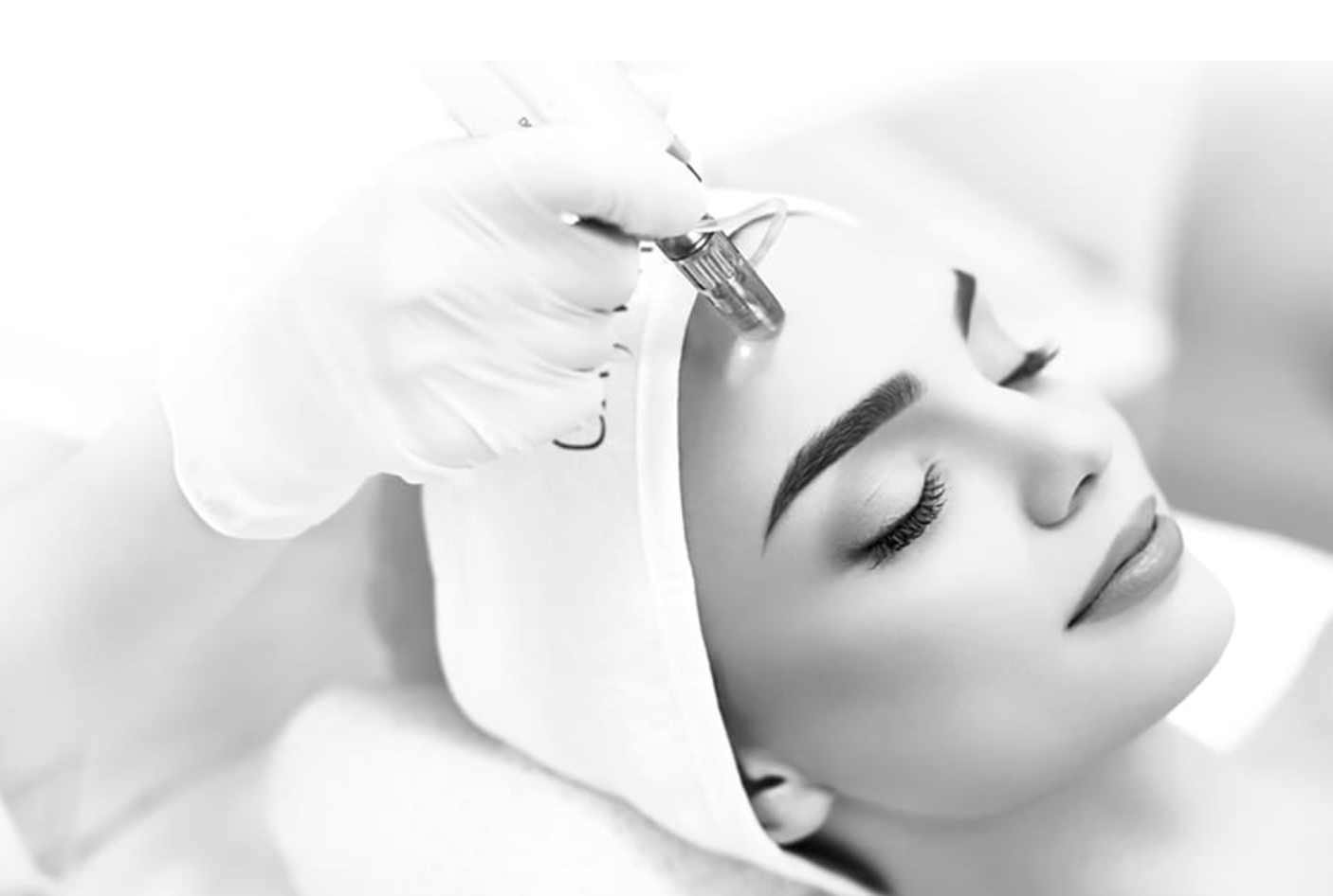 Tratamiento Dermapen